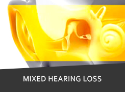 Hearing Loss Treatment Clinic in Mumbai